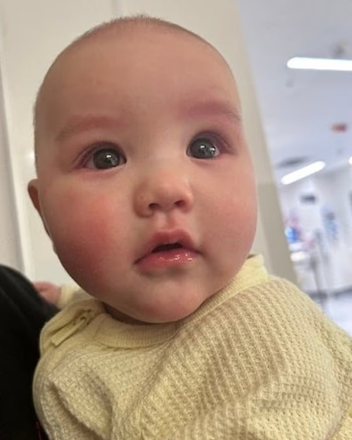 Primer plano de un bebé de 5 meses con un ojo hinchado, que aparece preocupado en un hospital después de un incidente de broma de extinción de incendios.