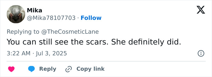 Tweet discutiendo a Simone Biles provocando rumores de cirugía plástica y jubilación con una nueva apariencia de vacaciones.