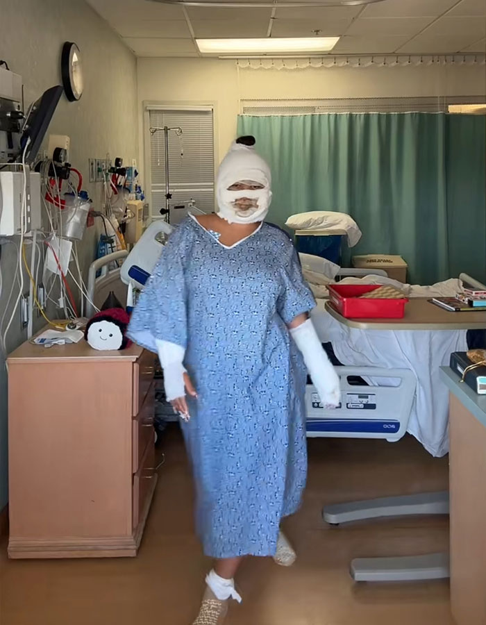 Adolescente con cara con vendas y manos caminan en la habitación del hospital después de desfigurar lesiones por accidente de S'mores.
