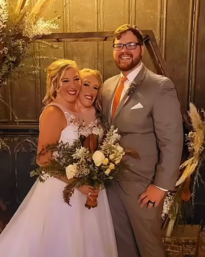 Hensel Twins sonriendo con el novio, sosteniendo ramos de boda, provocando especulaciones sobre la maternidad y el matrimonio.