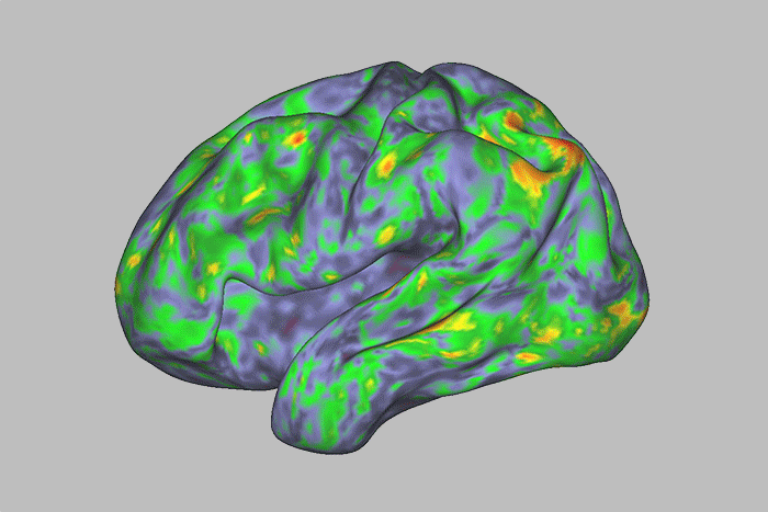 Este gráfico animado muestra un cerebro cuyas diversas regiones están cambiando de color de verde a amarillo a naranja a rojo.