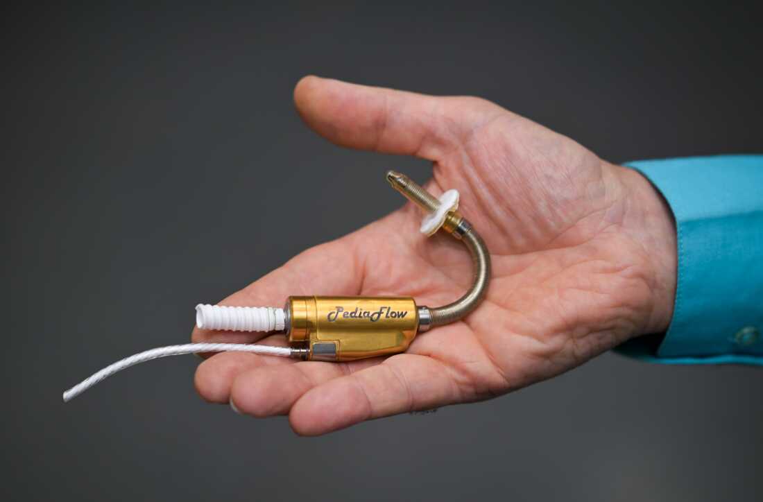 A hand holds a prototype of the PediaFlow, a heart-assist device for children. It looks like a gold AA battery with tubes coming out of each end.