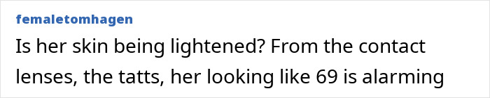 Comente sobre la advertencia de Kanye West sobre el resurgimiento de la vida en línea de su hija North después de su nueva y alarmante apariencia con piel aclarada y tatuajes.