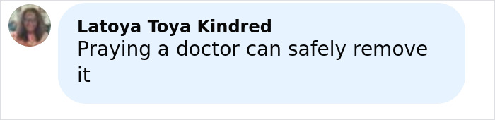 Un hombre con un gran tumor facial de 4 libras busca ayuda médica urgente después de que el médico emitiera una advertencia fatal en una publicación en línea.
