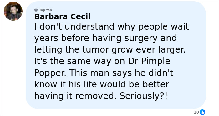 Comentario de Barbara Cecil sobre los motivos para retrasar la cirugía y las preocupaciones sobre un hombre con un tumor facial de 4 libras.