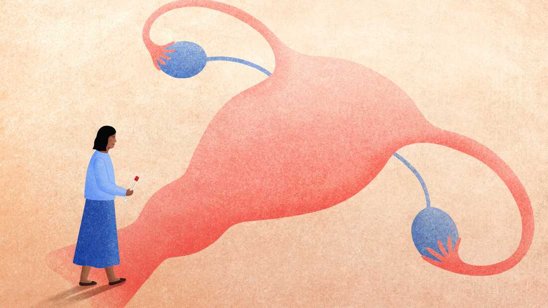 Una mujer considera sus opciones para la detección del cáncer de cuello uterino