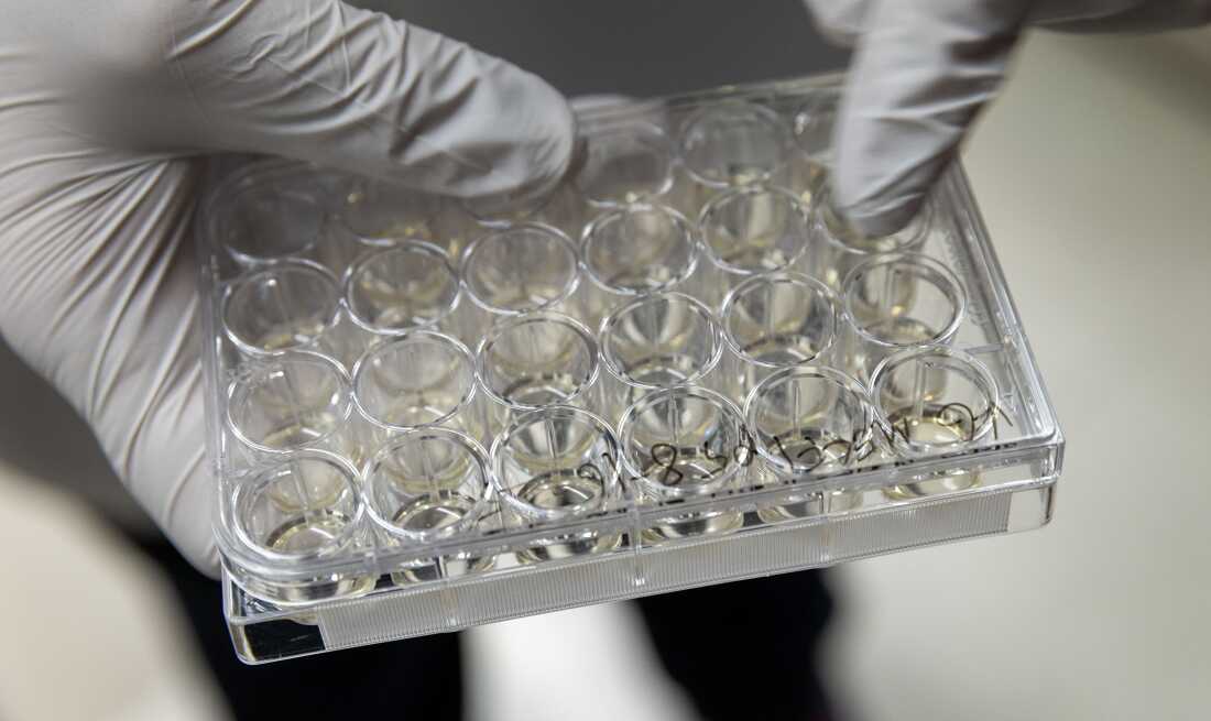 Esta fotografía muestra una bandeja de pruebas de laboratorio de plástico transparente llena de hileras de pocillos circulares. Una mano con guante blanco sostiene la bandeja.