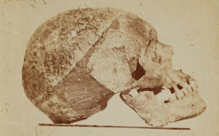 Escaneo del cráneo de una figura histórica utilizada por un científico para recrear rostros de Mozart, Bach y Beethoven.