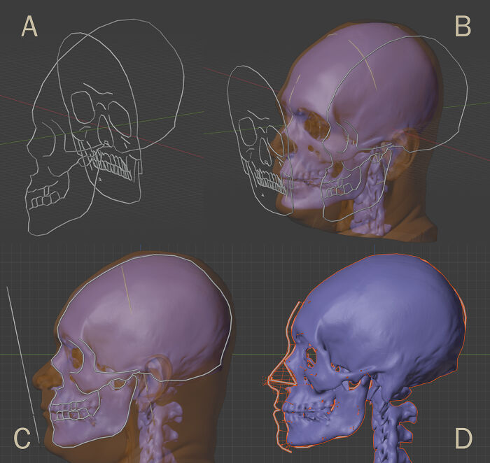 Escaneos de cráneo en 3D combinados con técnicas de reconstrucción facial para recrear rostros de Mozart, Bach y Beethoven.