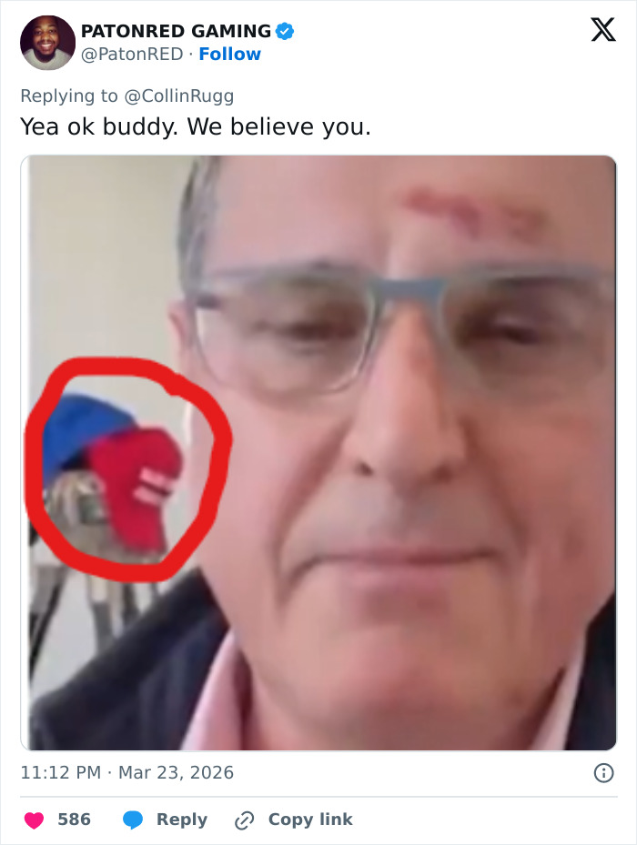 Hombre con gafas y una lesión en la frente, con un círculo rojo resaltando los sombreros, relacionado con el vecino en pelea con la estrella de Reacher, Alan Ritchson.